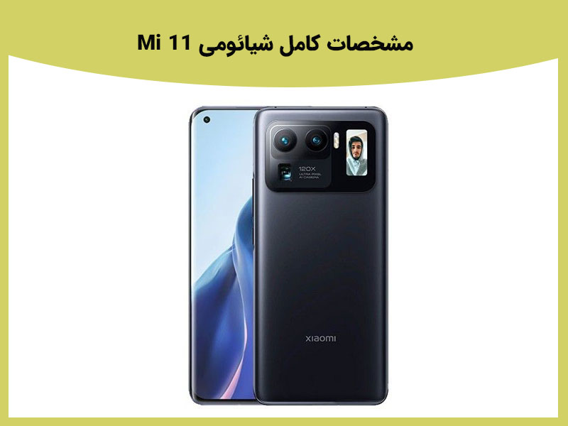 معایب شیائومی Mi 11